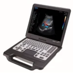 Сканер для ультразвукових досліджень SIUI APOGEE 1000 Lite-1 sante integrale портативний