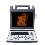 портативний сканер узд SIUI APOGEE 2100 sante integrale