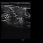 приклад узд досліджень SIUI CTS 5000