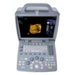 портативний переносний сканер доплер узд SIUI CTS 8800 Plus sante integrale