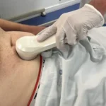 сканування сечового міхура узд датчиком sante integrale міні ехограф приклад використання
