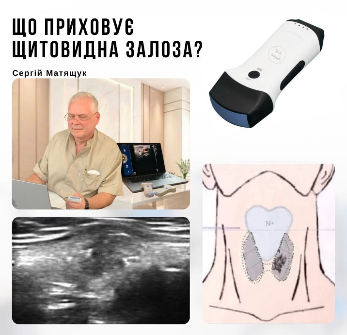 Блог sante integrale