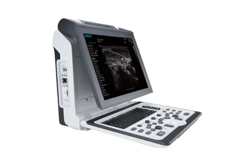 Сканер-ноутбук SIUI APOGEE 2100 sante integrale