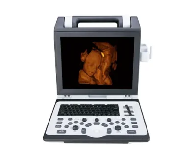 портативний сканер узд SIUI APOGEE 2100 sante integrale
