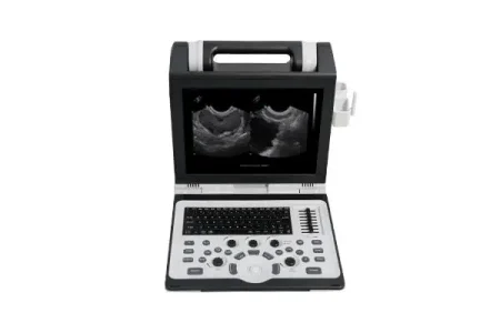 Портативний переносний сканер узд SIUI APOGEE 2300 Pro sante integrale