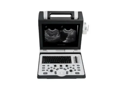 Портативний переносний сканер узд SIUI APOGEE 2300 Pro sante integrale