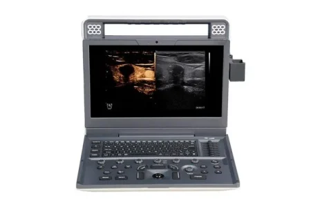 сканер портативний переносний узд SIUI APOGEE C2 sante integrale