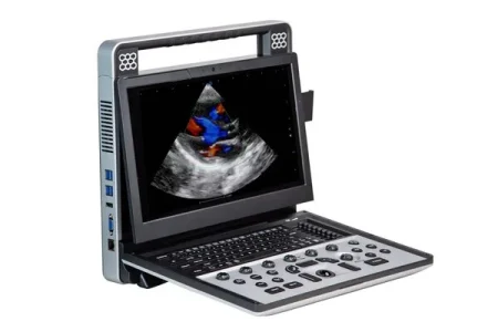 портативний сканер узд SIUI APOGEE C5 sante integrale