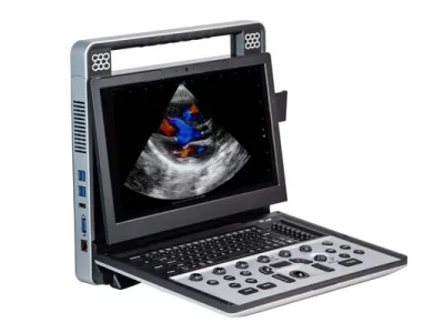 портативний сканер узд SIUI APOGEE C5 sante integrale