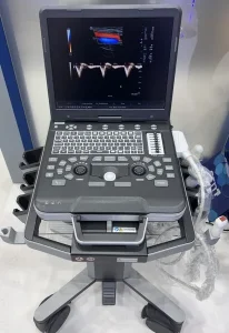 сканер узд SIUI Apogee 1000 Pro-1 sante integrale з кольоровим монітором на підставці з колесами