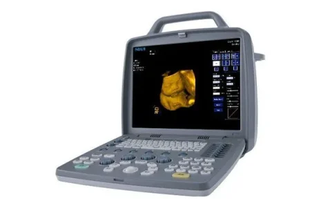 портативний переносний сканер ноутбук узд SIUI CTS 8800 Plus sante integrale