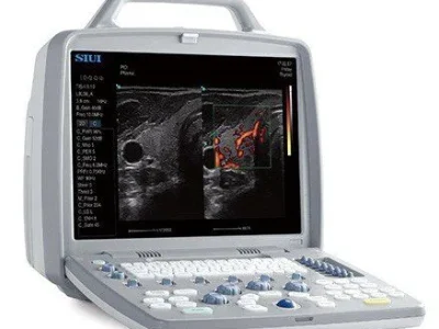 портативний сканер узд SIUI CTS 8800 Plus Color sante integrale